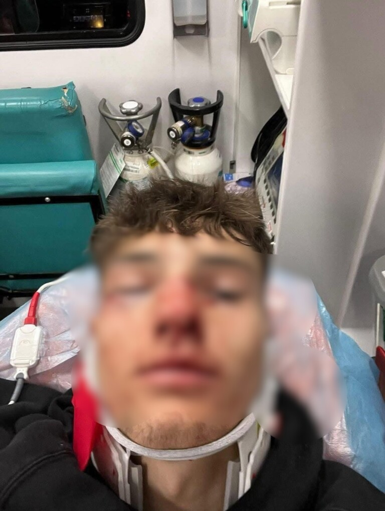Read more about the article Suporterul ”U” Cluj care a lovit cu o sticlă un fan al CFR după derby-ul dintre cele două echipe a fost reținut astăzi. Are 38 de ani