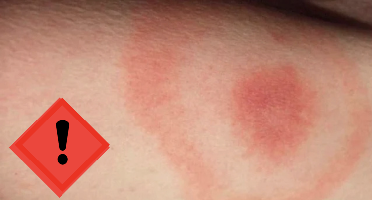 Read more about the article Insecte agresive într-un parc din Cluj. Locatarii cer o dezinzecție rapidă și eficientă