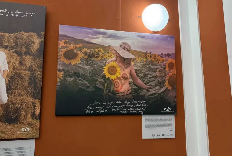 Expoziția (On) Cool Art, la Casino: cicatrici devenite artă